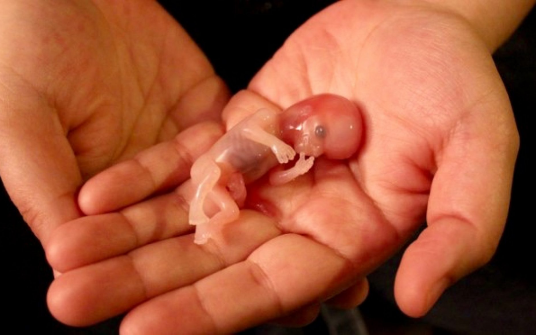 Avortement et colonisation